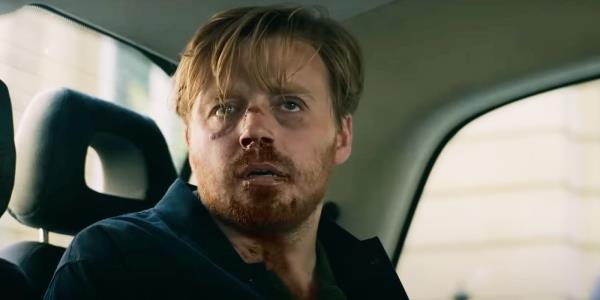 Jack Lowden with a bloody nose and two black eyes in Slow Horses season 3.